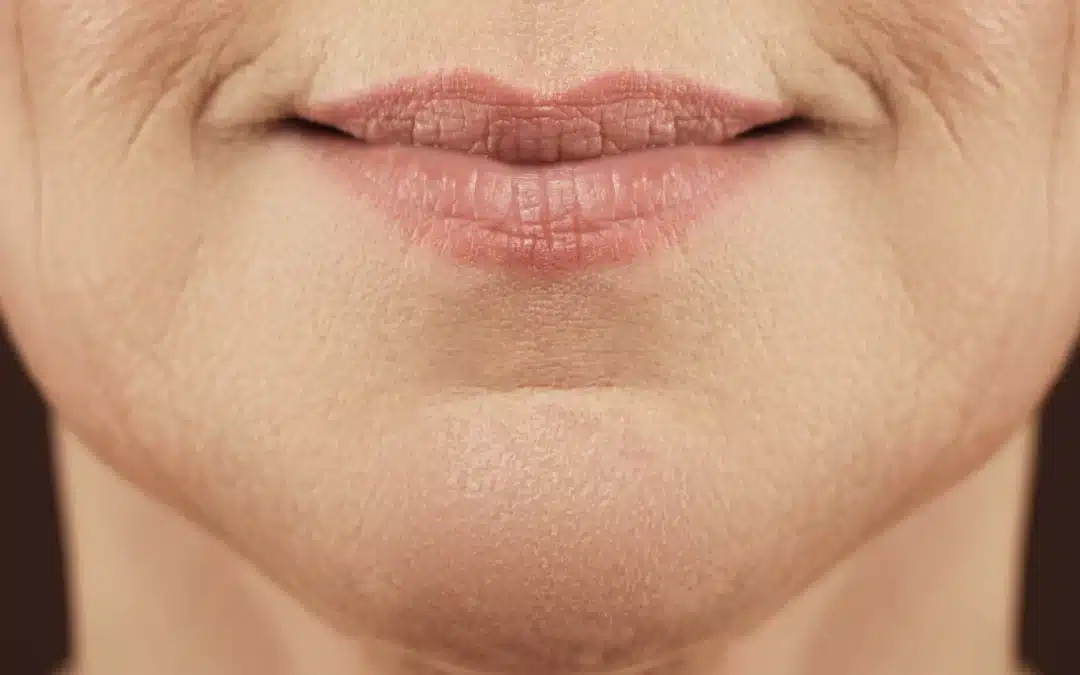 NeoGen Plasma for Lip Lines: The Non-Surgical Secret to Softer, Smoother Lips