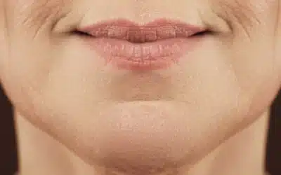 NeoGen Plasma for Lip Lines: The Non-Surgical Secret to Softer, Smoother Lips